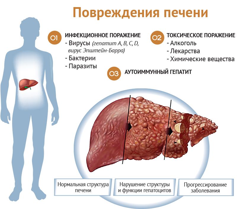 2-Zabolevaniya_pecheni_simptomy_i_priznaki_bolezni.jpg